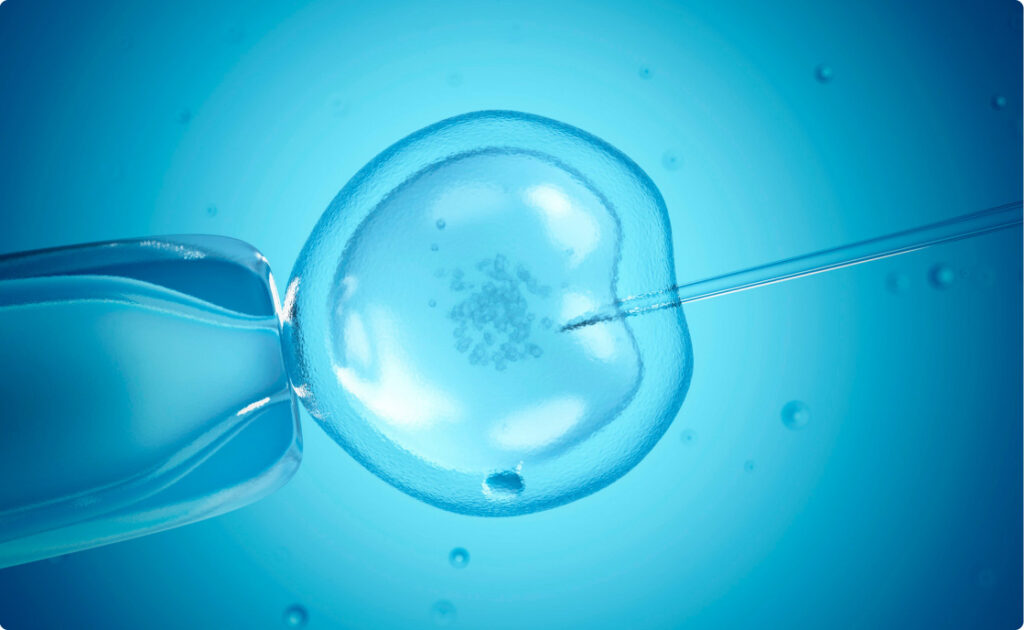 Bạn cần lựa chọn phương pháp hỗ trợ sinh sản (IUI/IVF) phù hợp với gia đình
