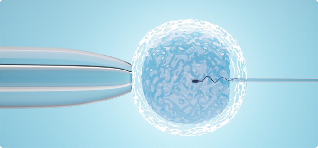 IVF là gì?