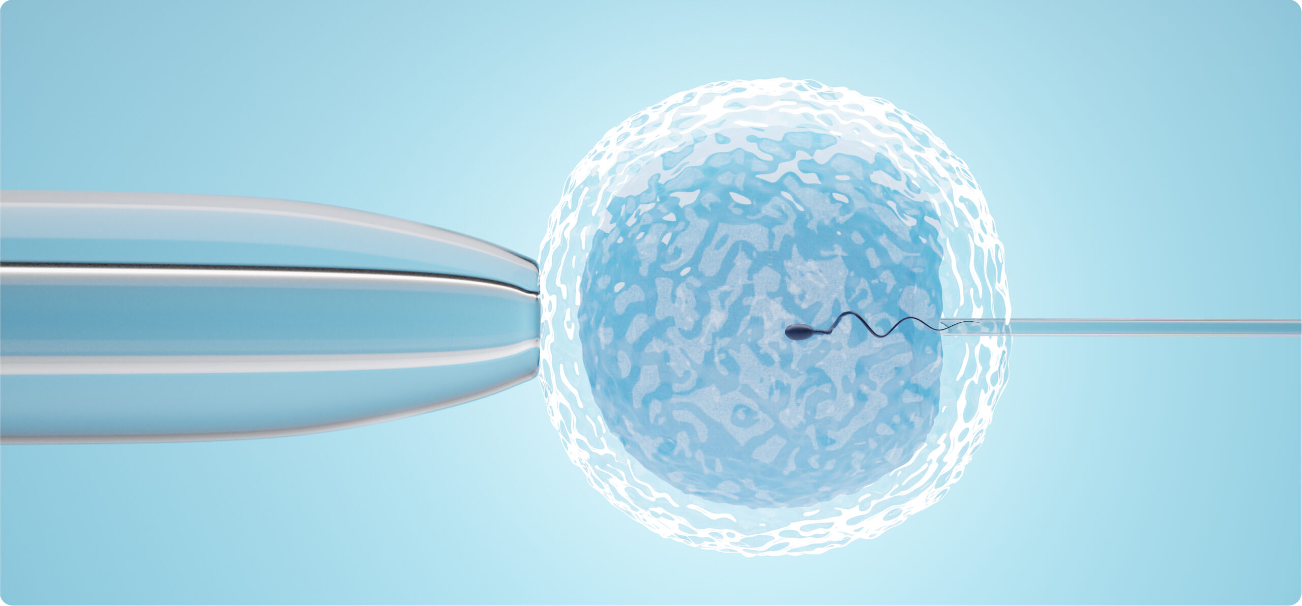 IVF