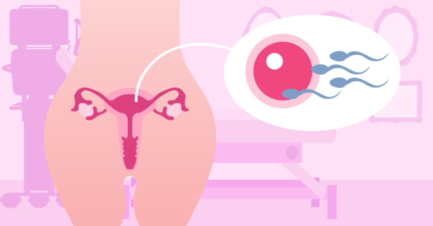 Quá trình kích trứng là giai đoạn quan trọng của chu trình IVF