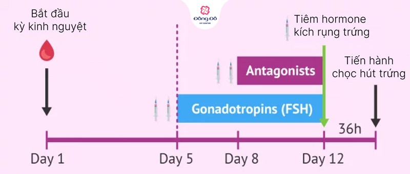 Quy trình thực hiện Mini IVF chi tiết