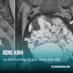 rong kinh